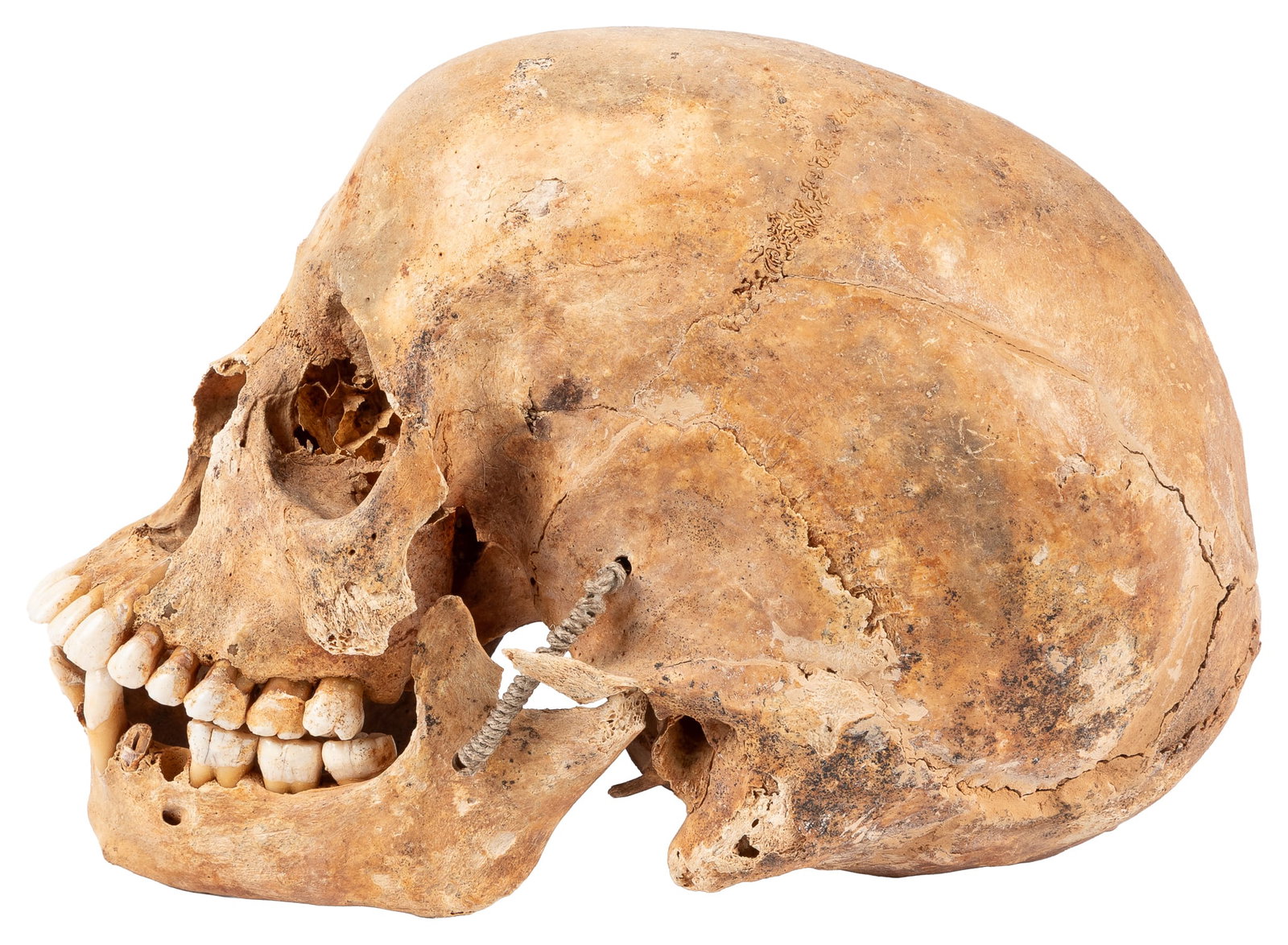 Human skull. - 2