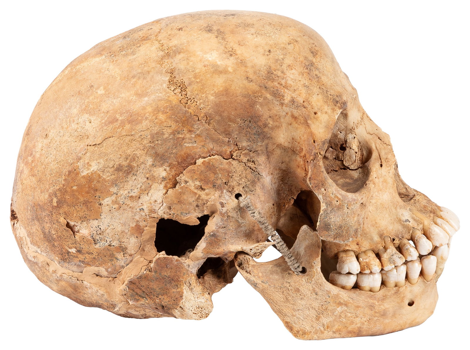 Human skull. - 3