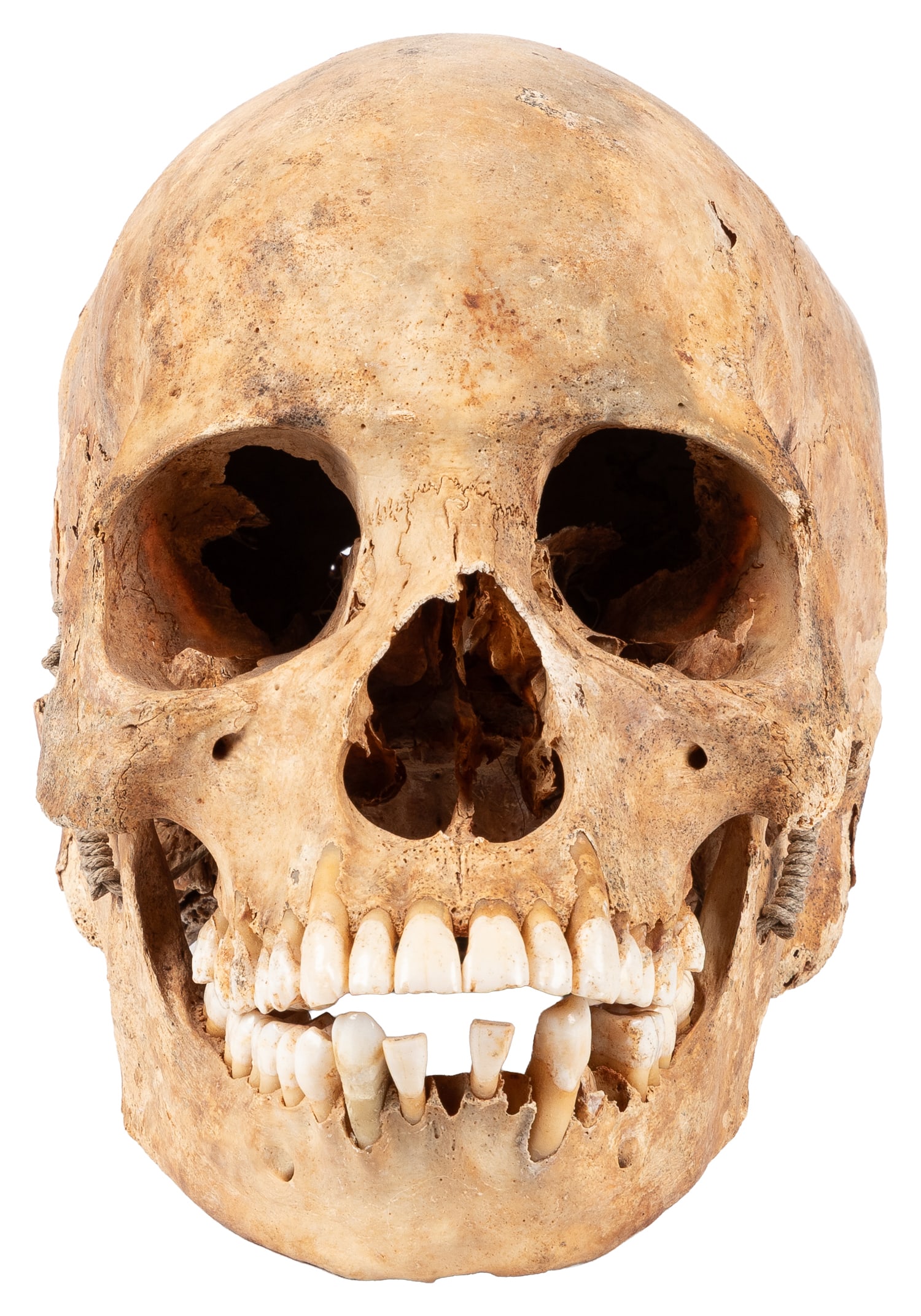 Human skull. - 4