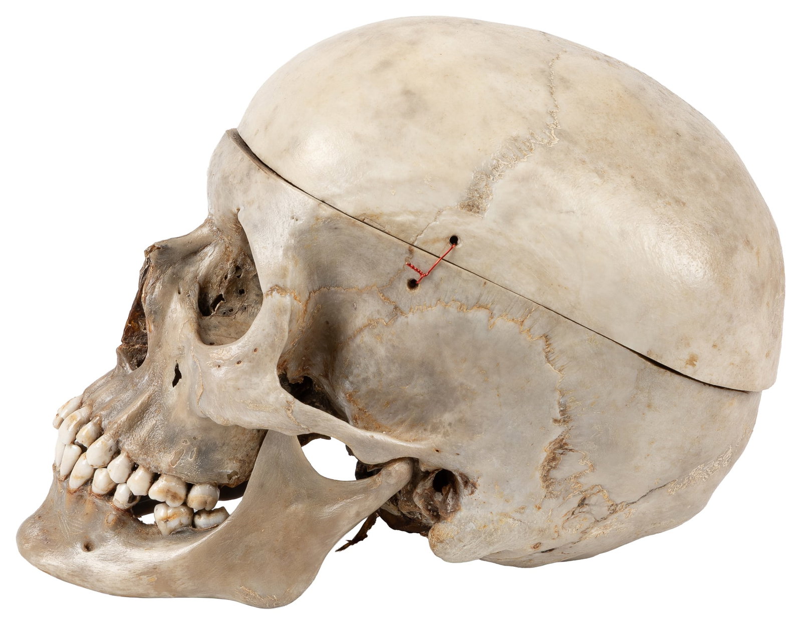 Human skull specimen. - 2