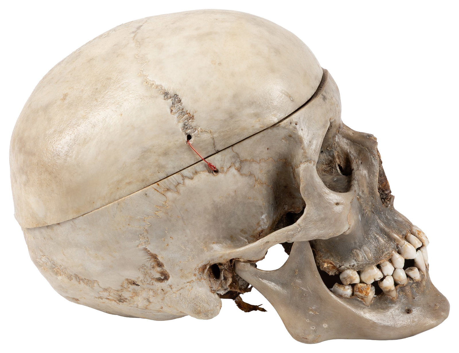 Human skull specimen. - 3