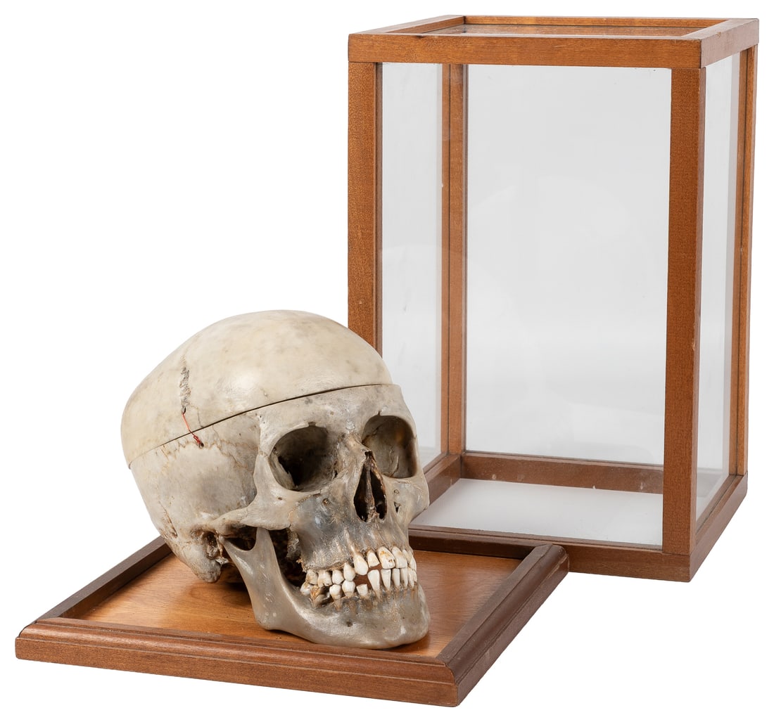 Human skull specimen. - 4