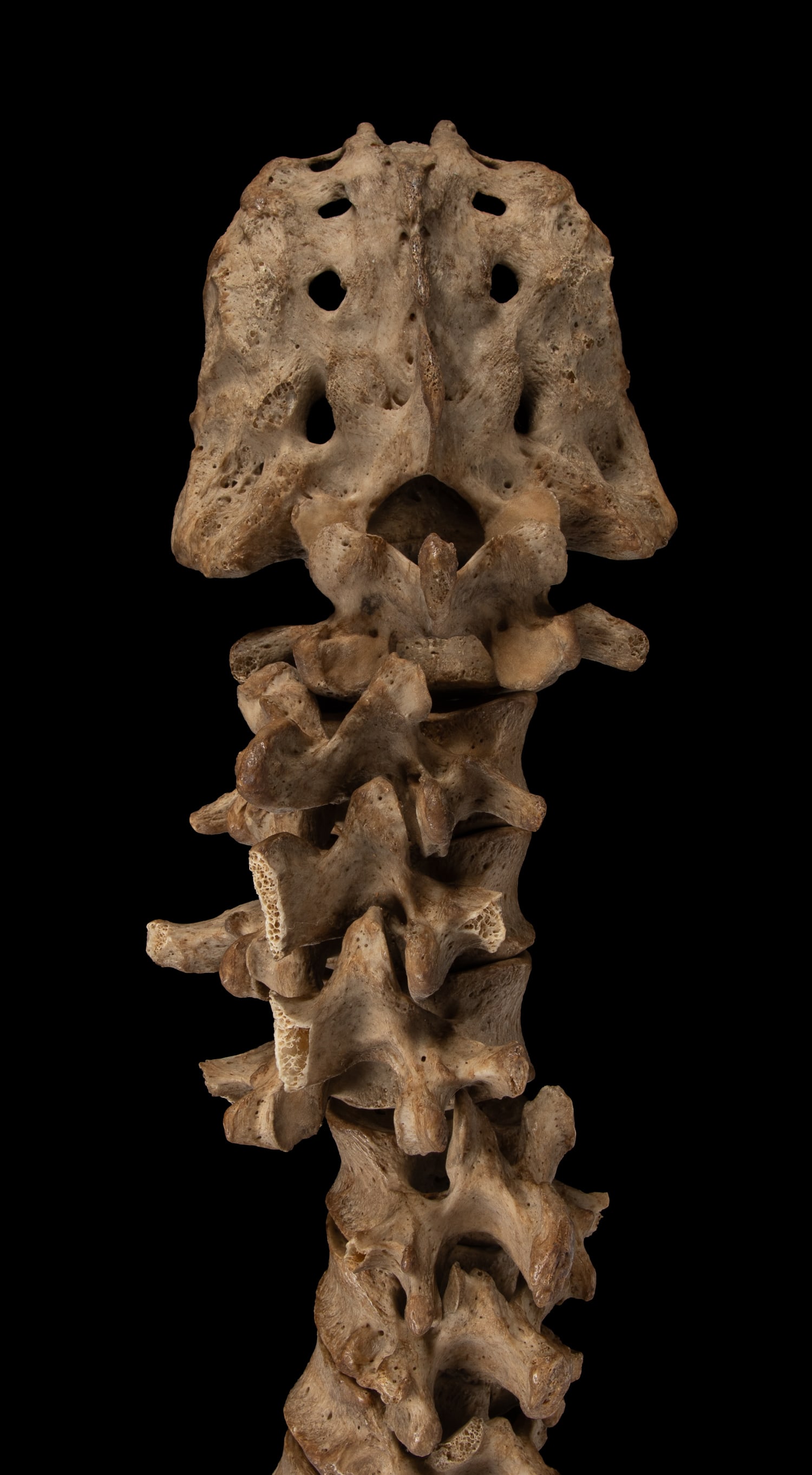 23" Partial Human Spinal Column and Sacrum. - 2