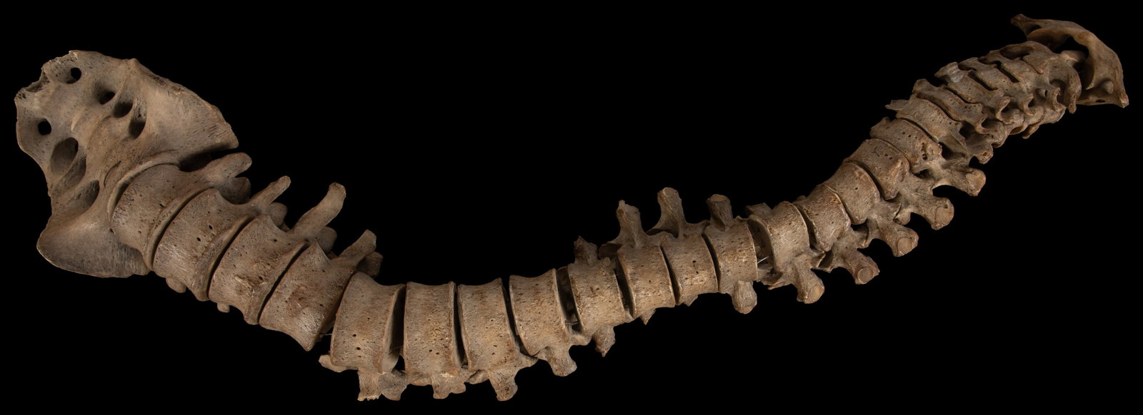 23" Partial Human Spinal Column and Sacrum. - 3