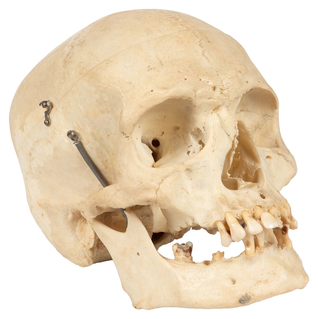 Clay Adams Articulated Human Skull Specimen. (1 of 3)