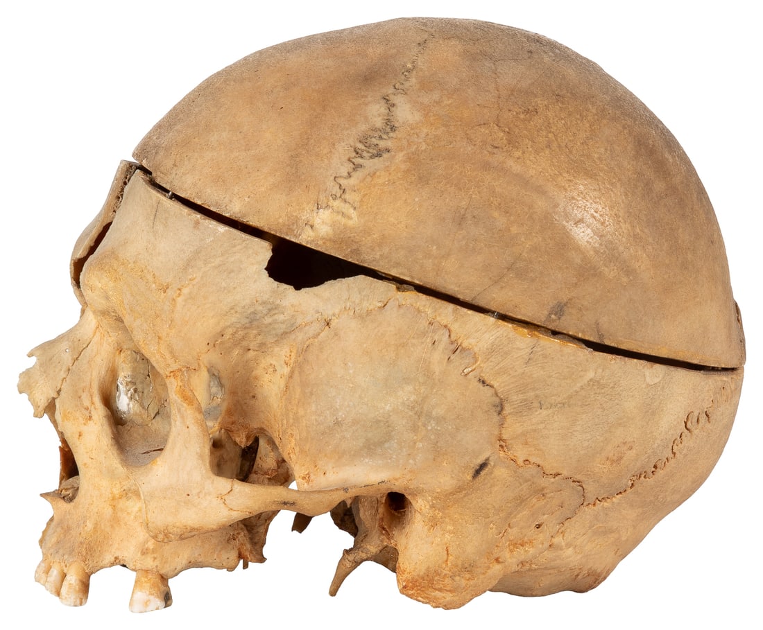 Sagittal Cut Model Skull with Cap. - 2