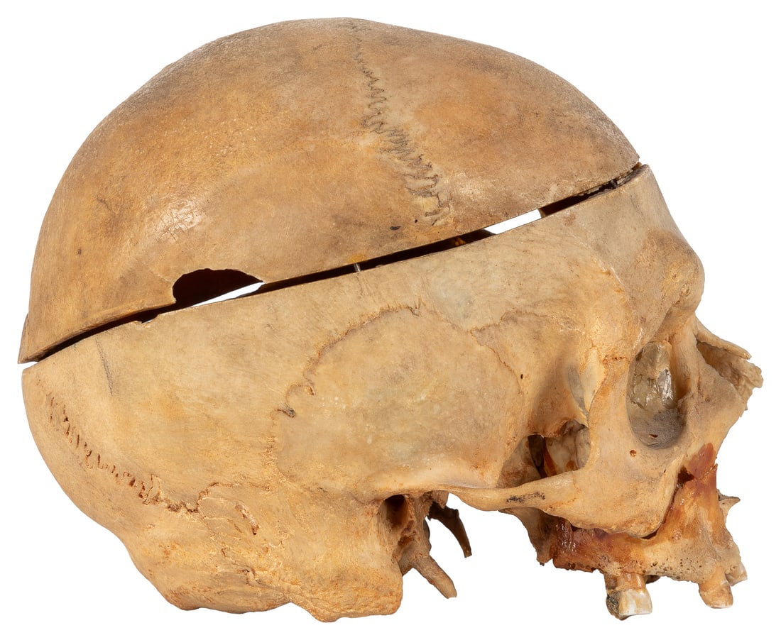 Sagittal Cut Model Skull with Cap. - 3
