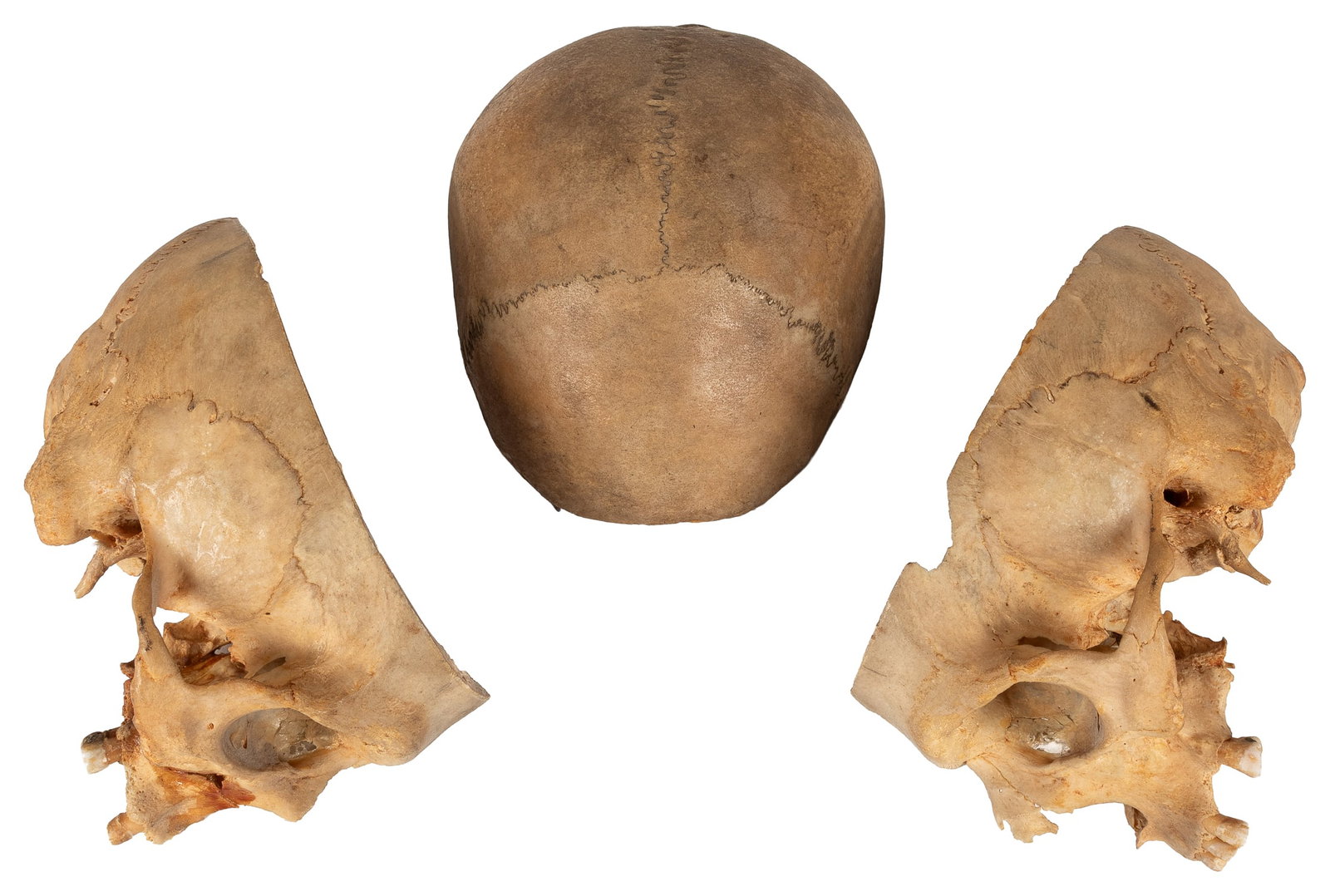 Sagittal Cut Model Skull with Cap. - 4