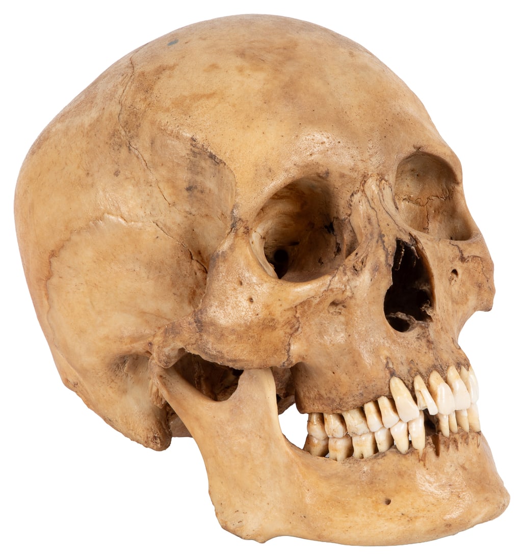 Antique human skull specimen.: Antique human skull specimen. Male human skull, retaining 30 teeth. Mandible detached. 7 x 5 1/2 x 8".