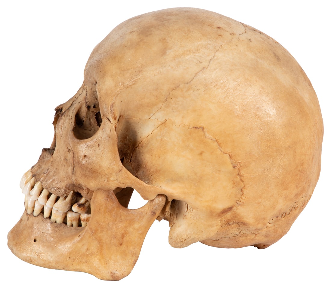 Antique human skull specimen. - 2