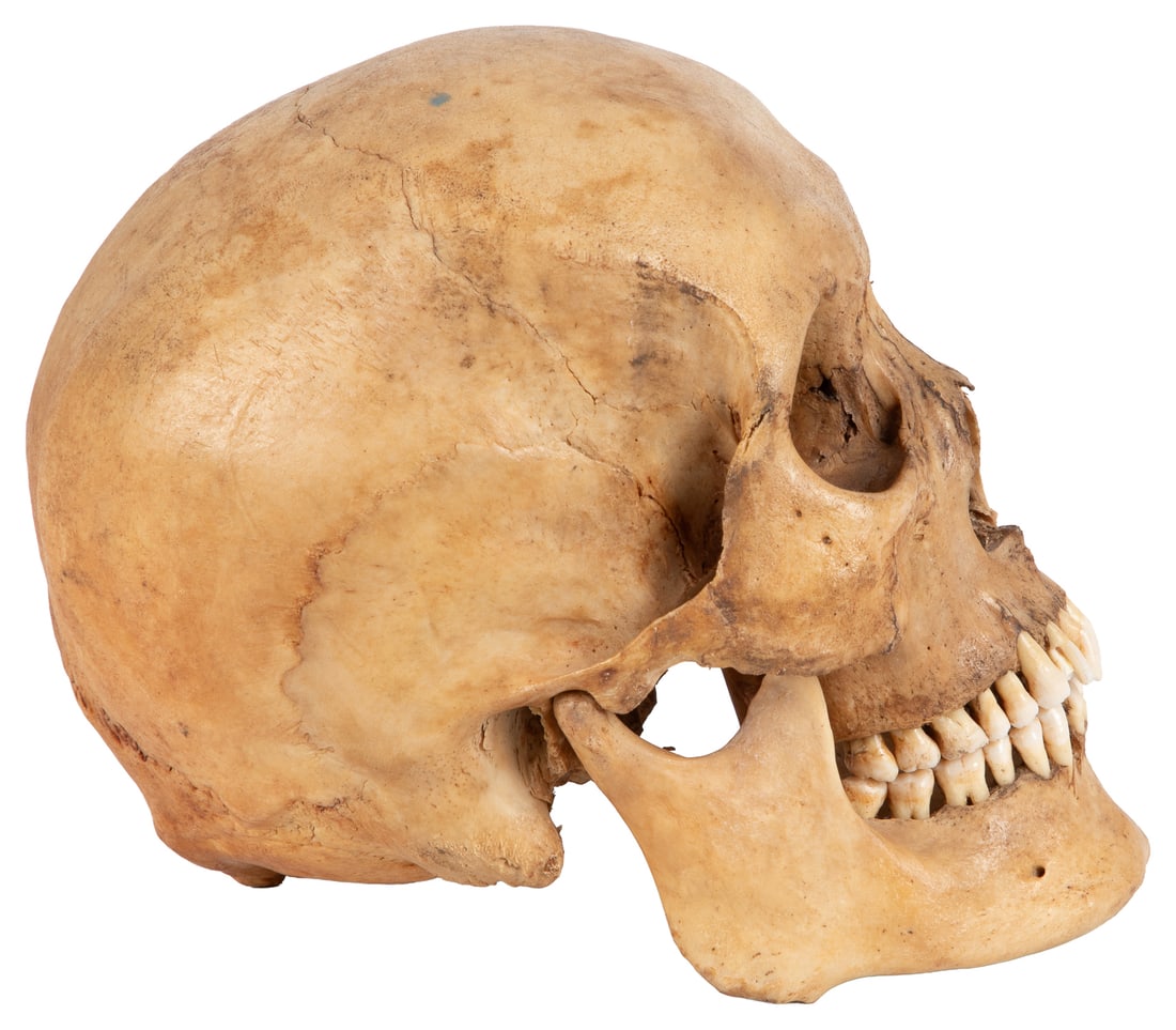 Antique human skull specimen. - 3
