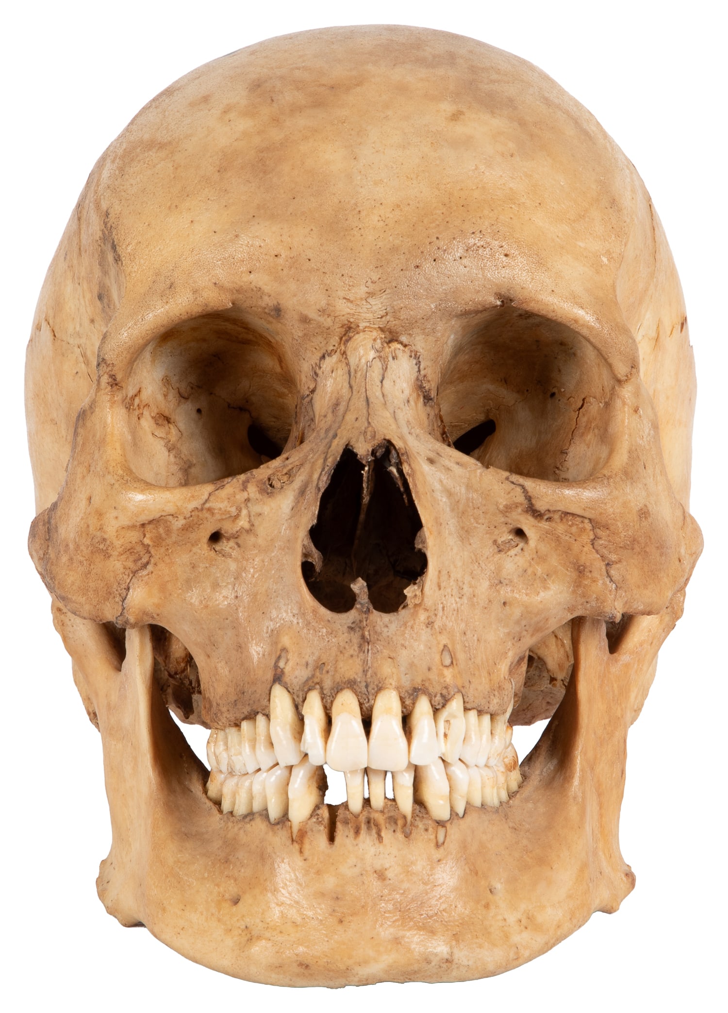 Antique human skull specimen. - 4