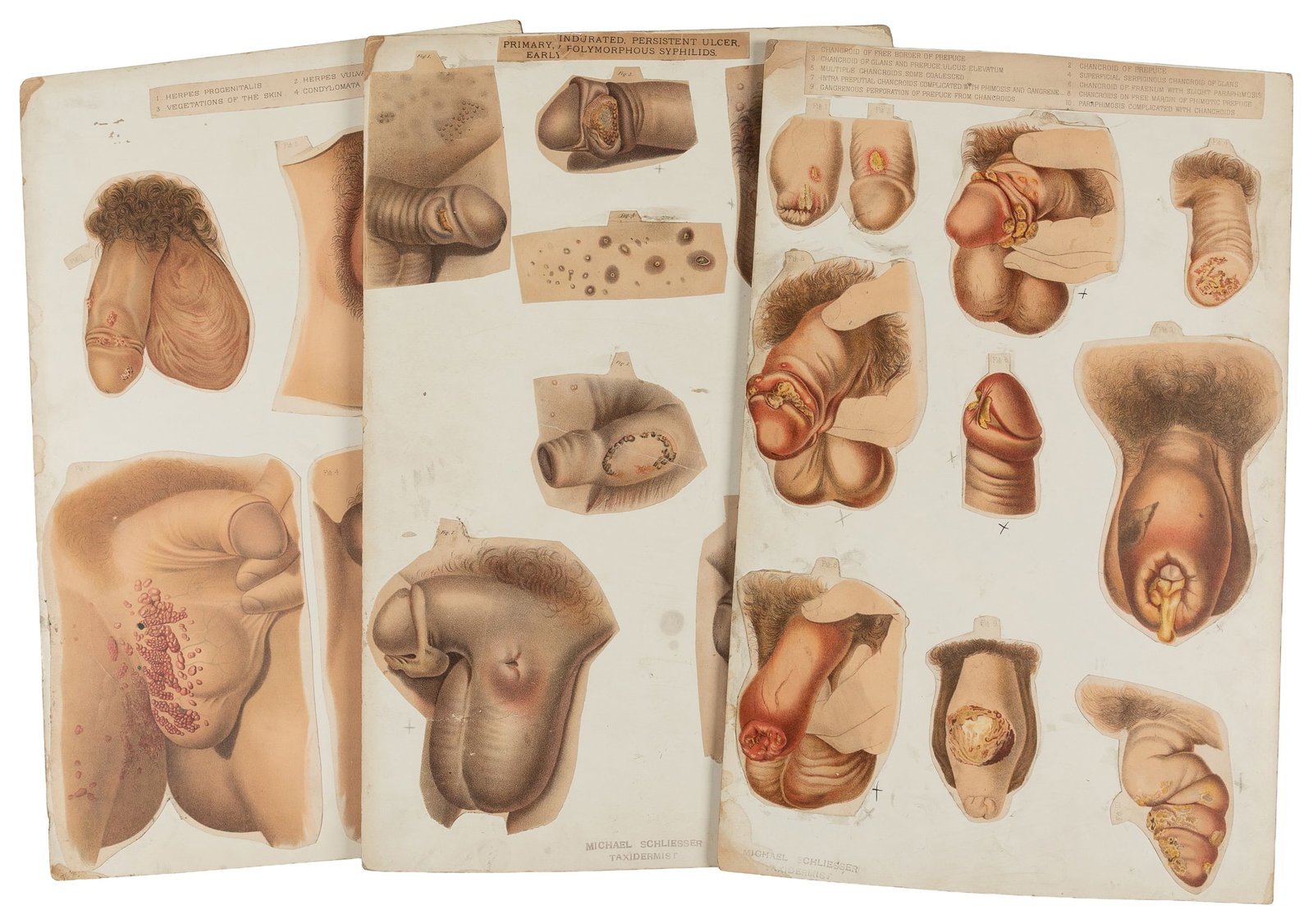 Three Anatomical Display Panels of Male Genitalia. Circa early 20th century. (1 of 4)