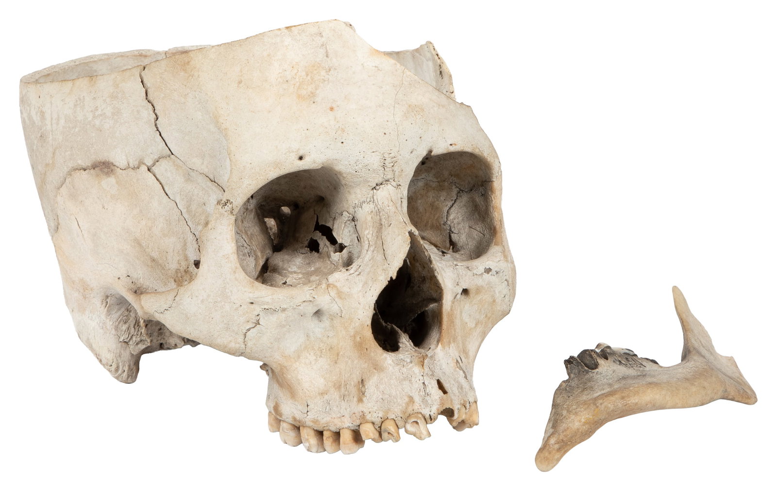 Partial Human Skull and Mandible Fragment with Teeth. (1 of 4)