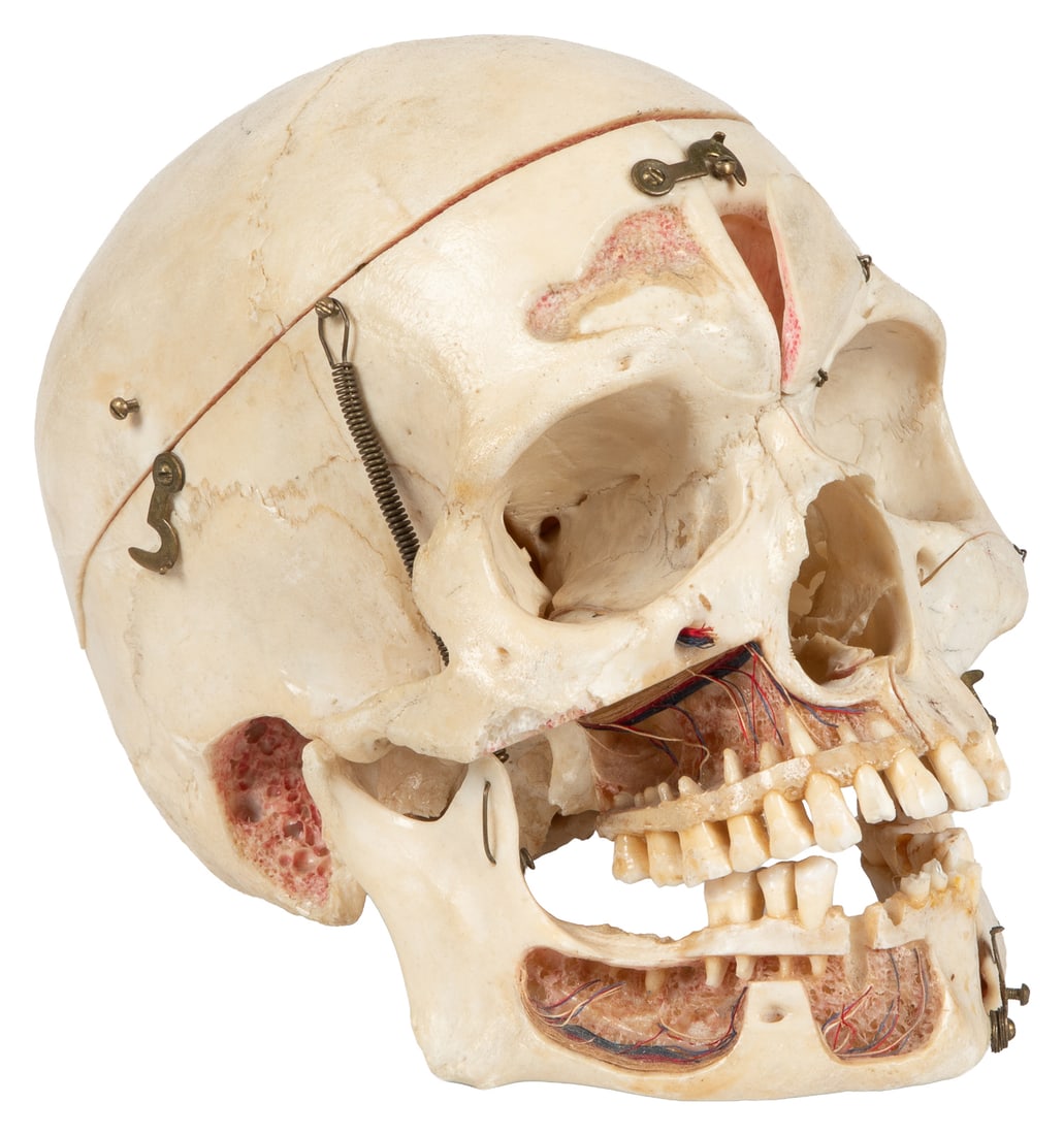 Dissected Human Skull Model in Glass Display Case. Mid 20th century.: Dissected Human Skull Model in Glass Display Case. Mid 20th century. Medical demonstration model skull with removable and cut-away sections hinged with springs and clasps for revealing hand-colored