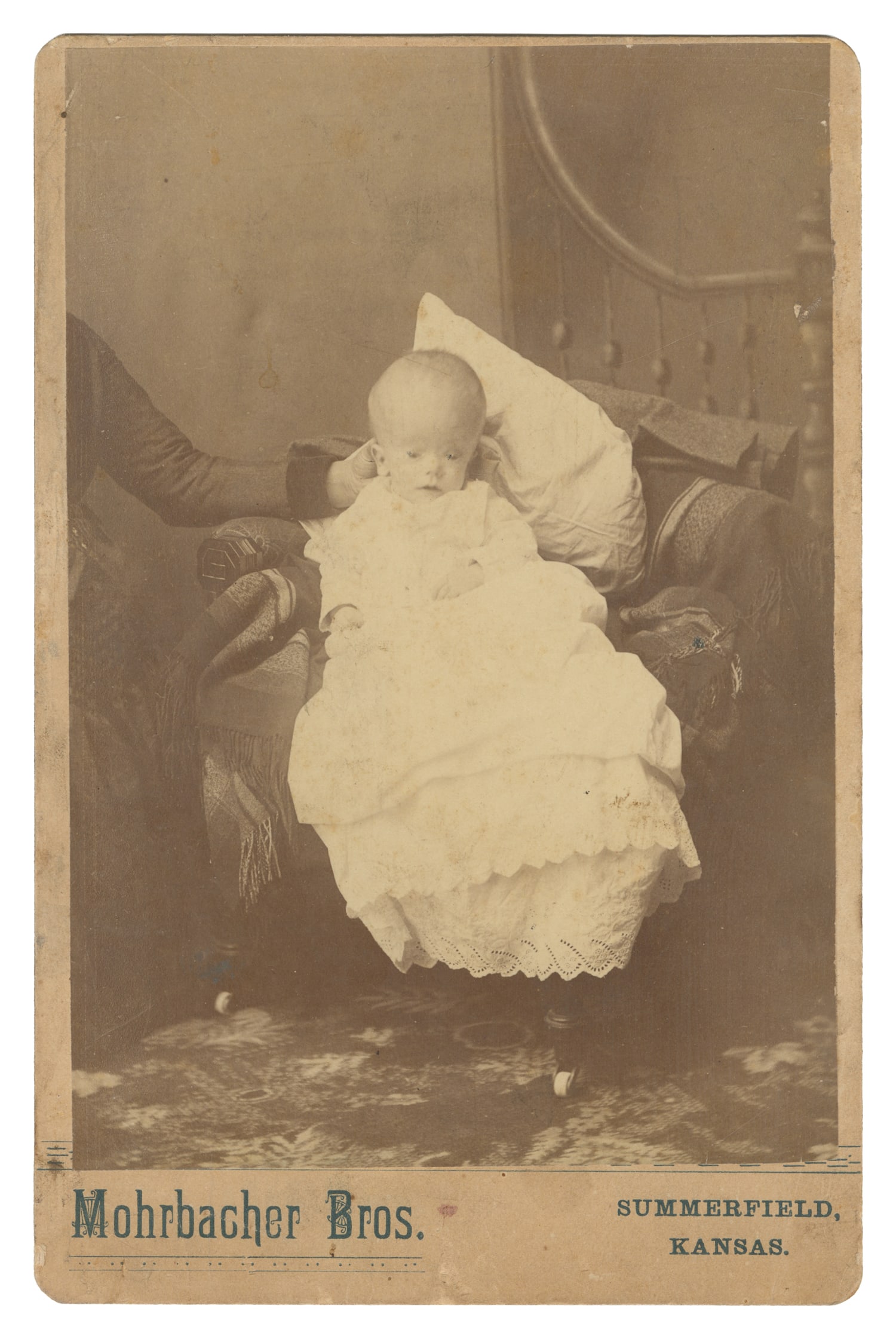 Cabinet Card of Baby with Hydrocephalus. Summerfield, KS: Mohrbacher Bros., ca. early 19th century.: Cabinet Card of Baby with Hydrocephalus. Summerfield, KS: Mohrbacher Bros., ca. early 19th century. Albumen print on studio mount. Features a 'hidden mother' supporting the baby, who is perhaps