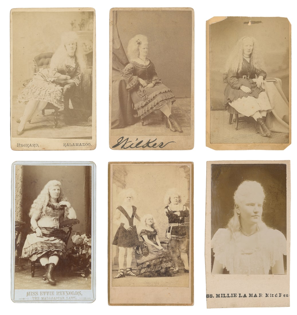 Six CDVs of Albino Performers. V.p., circa late 19th century. (1 of 1)