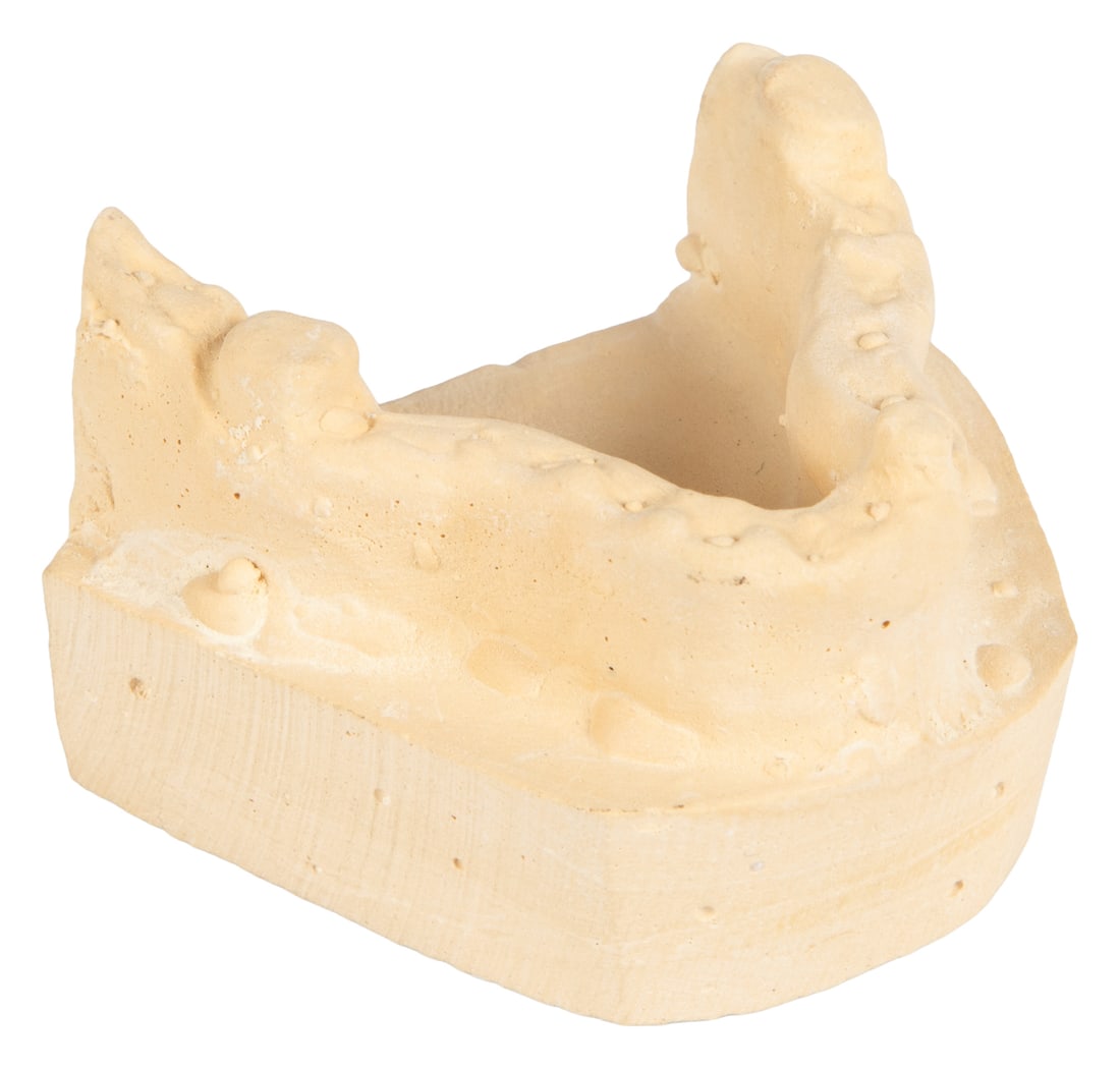 Mandible Cast from Alien Jawbone with Recorded Cassette. 1979 and 1993.: Mandible Cast from Alien Jawbone with Recorded Cassette, 3 Transparencies and 2 Page Assessment from Dental Lab. 1979 and 1993. Cast plaster. Cassette tape. Inscribed: WPAFB (Wright-Patterson Air Forc