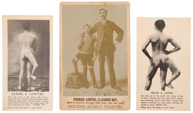 Francis Lentini 3-Legged Boy. Sideshow Cabinet Card. (1 of 1)