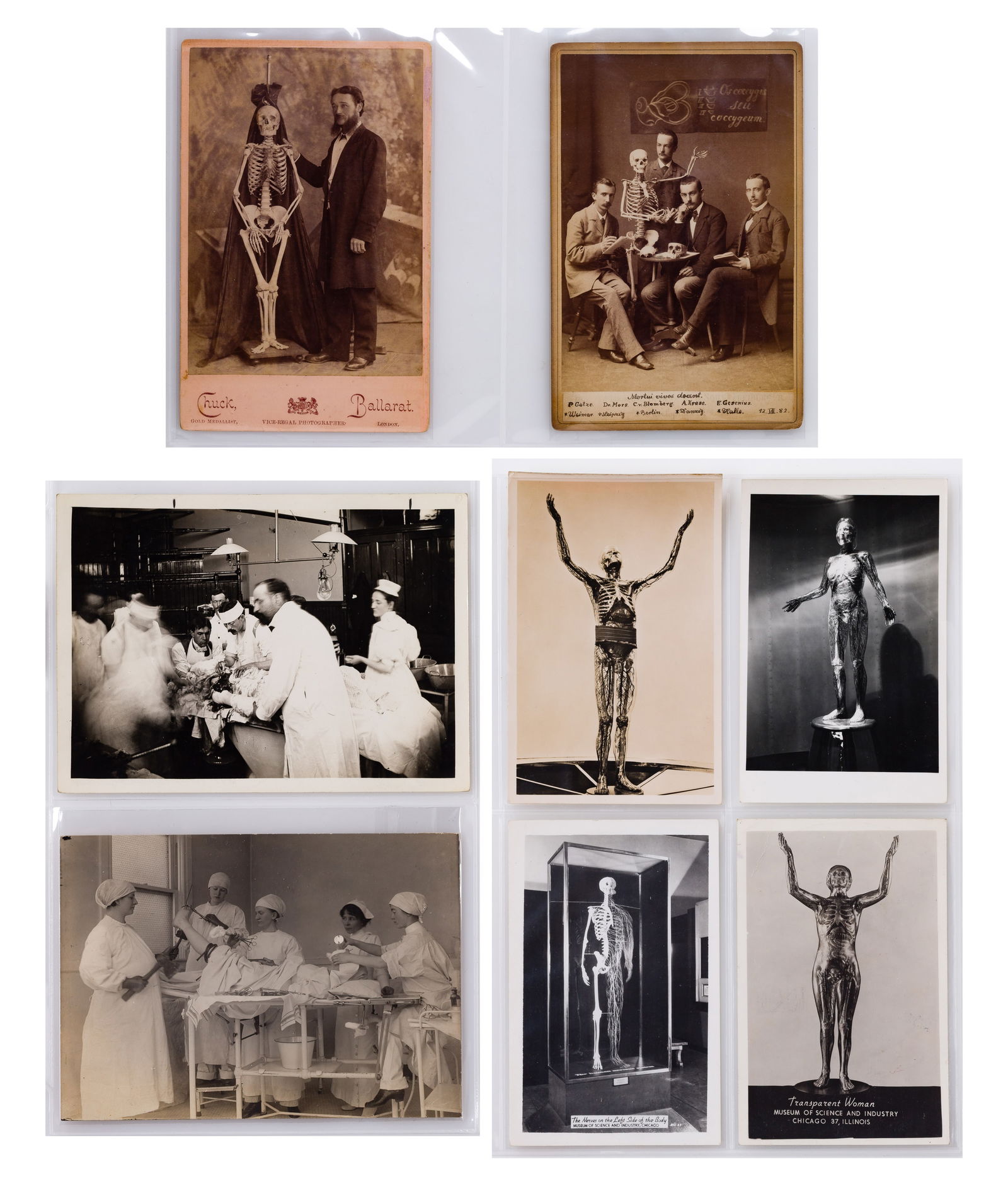 Medical and Body of Science Photographic Assortment: Medical and Body of Science Photographic Assortment Approximately (300) items of various sizes and subjects, including postcards, cartes de visite and photographs, such as (2) boxes of the Edinburgh U