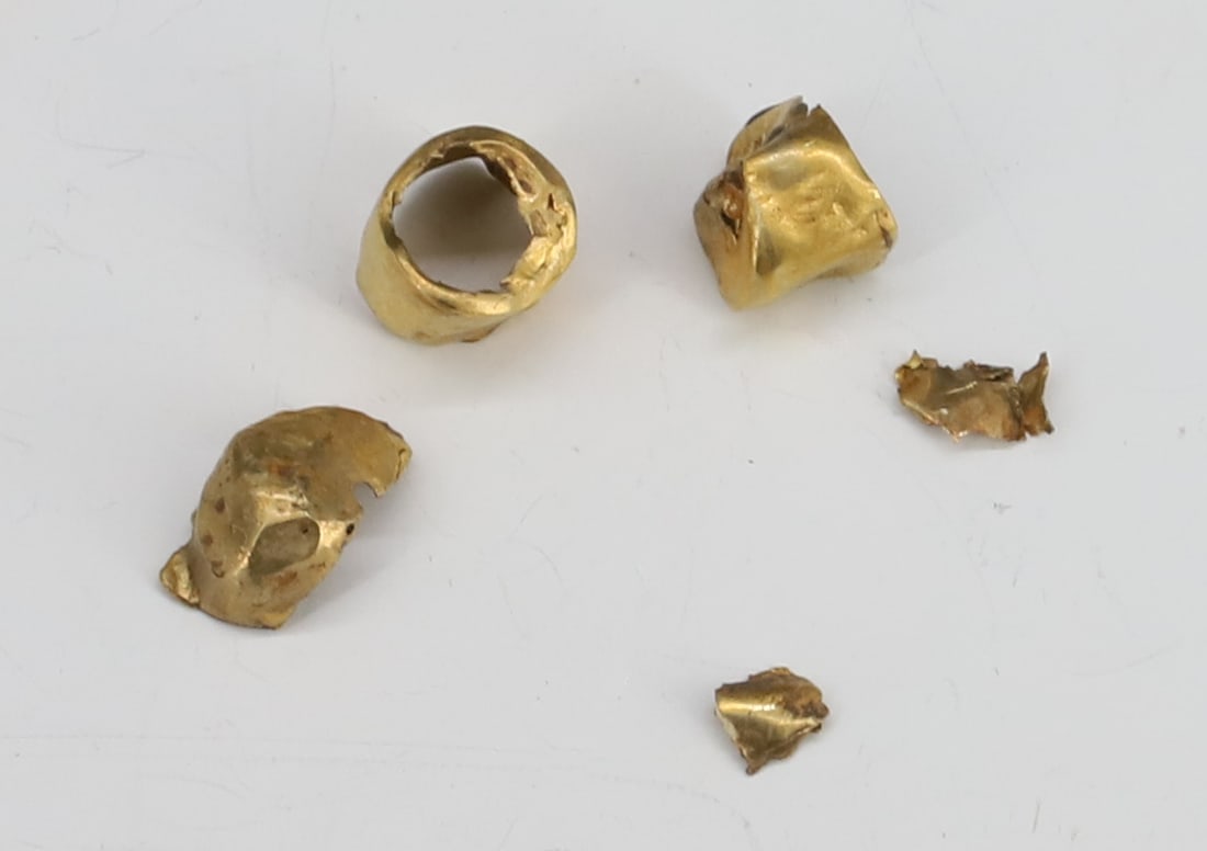 16K DENTAL GOLD: 1.35 DWT PLEASE READ CAREFULLY - SINCE THIS IS A COIN SALE PLEASE NOTE. ITEMS MUST BE PAID FOR THROUGH LIVE AUCTIONEERS OR WITH CASH OR CHECK IN PERSON - Terms for Purchasing and Shipping of