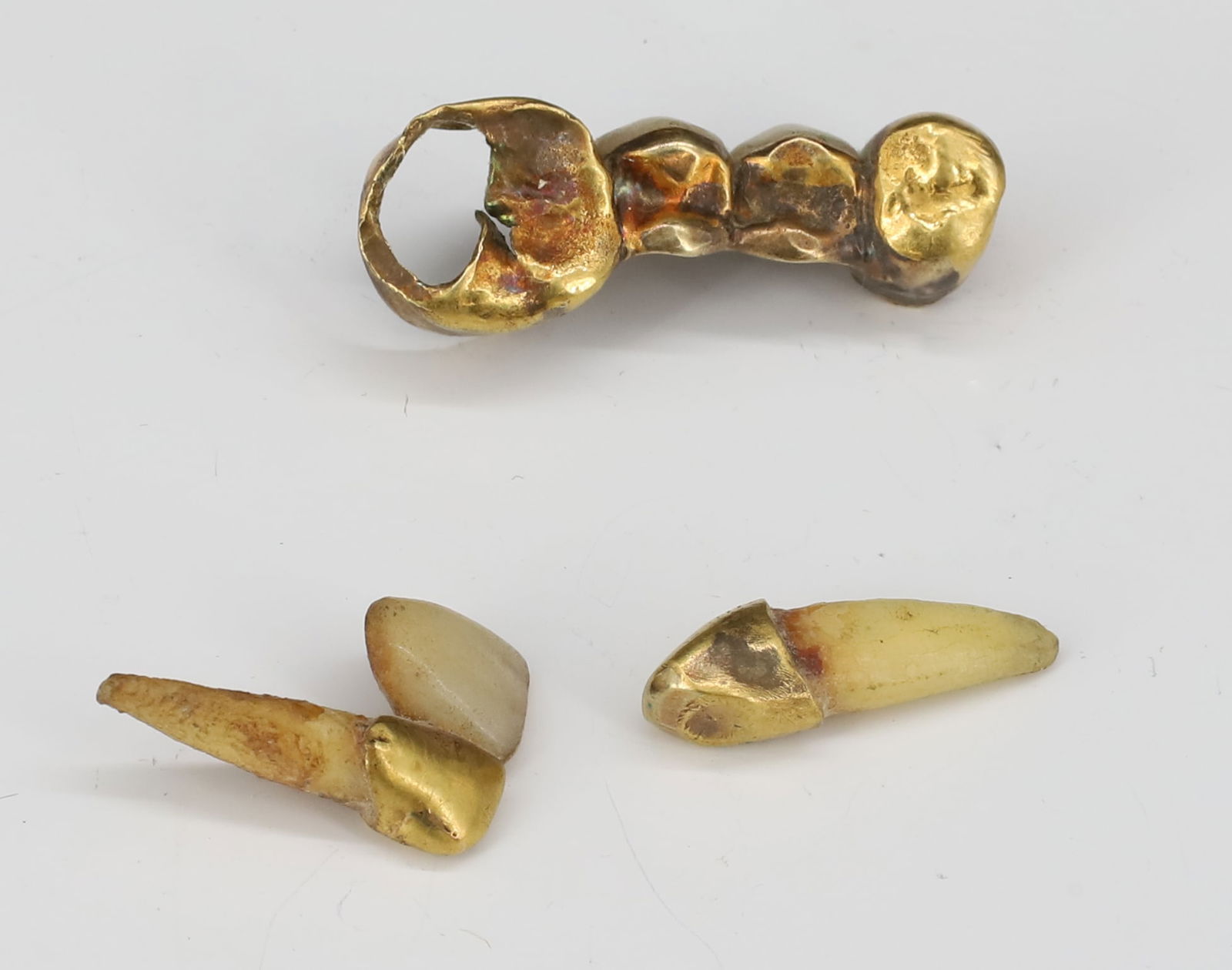 16K DENTAL GOLD (1 of 2)