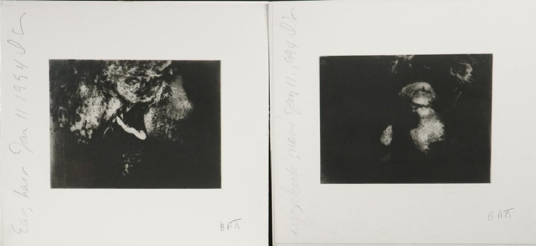 DONALD KEITH SULTAN (NY/NC, 1951 - ): (2) Original Black & White Aquatints, both signed and titled, from editions of six, including: "Ear, hair, Jan 11, 1994" & "Eye, cheek, nose, Jan 11, 1994". Unframed, shrinkwrapped over foamcore, shee