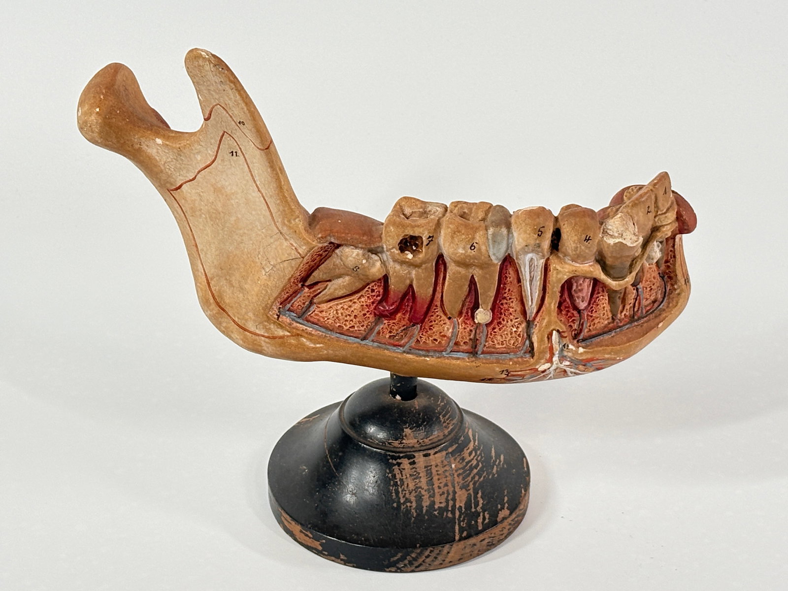 ANTIQUE ANATOMICAL JAWBONE MOLAR MANDIBLE DENTAL INSTRUCTION MODEL (1 of 5)