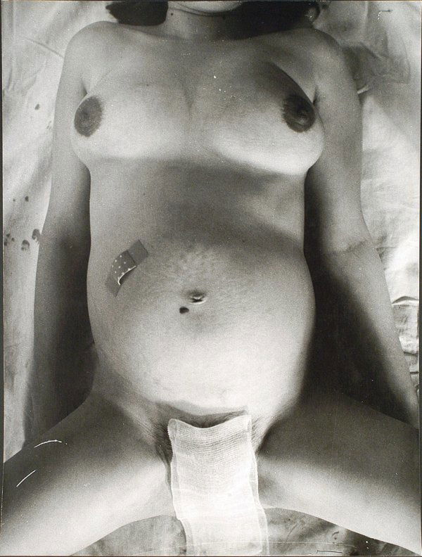 Hermann Nitsch (1938): Senza titolo stampa fotografica esemplare 6 di 15 Dimensione: 65x50 cm.