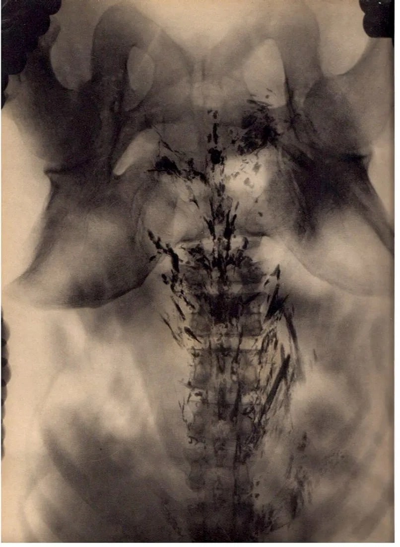 Prof. Contremoulin Print: Prof. Contremoulin Print. Radiographie. Printed in 1930. 8.5" x 11" inches. Not hand-signed unless otherwise stated. Photomechanical Print. Lots that contain nudity have been partially obscured in the