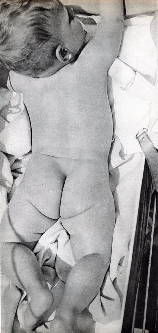 Herbert Bayer (American, 1900-1985) Print: Herbert Bayer (American, 1900-1985) Print. "Baby". Printed in 1931. 5" x 11" inches. Not hand-signed unless otherwise stated. Photomechanical Print. Lots that contain nudity have been partially
