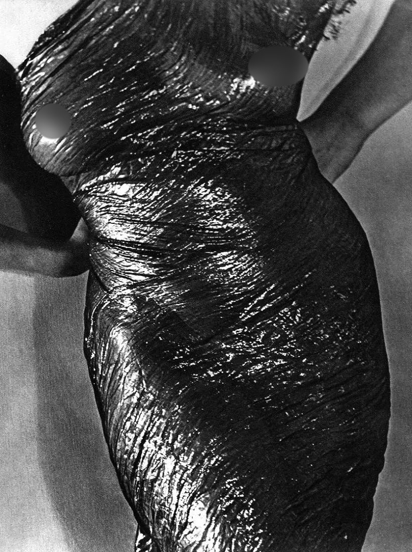 Man Ray (American, 1890-1976) Print: Man Ray (American, 1890-1976) Print. Anatomy. Printed in 1934. 9.00 x 11.00 inches. Not hand-signed unless otherwise stated. Photomechanical Print. Lots that contain nudity have been partially obscure