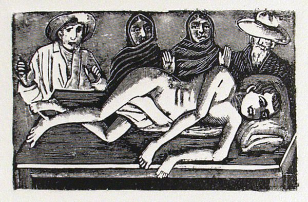 JOSE GUADALUPE POSADA - Etching: Jose Guadalupe Posada (Mexican, 1852 - 1913). "Untitled [Legs for Arms]". Etching. c1900?. Printed later. Full margins. Excellent impression. Fine impression. Restrike impression by Jaled Muyaes from 