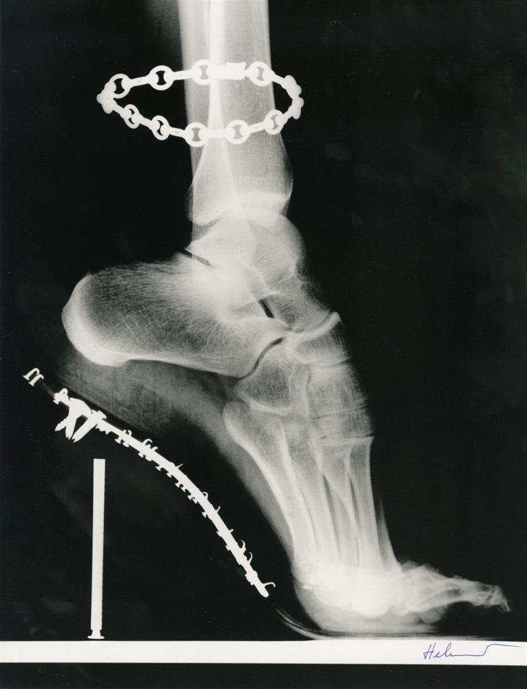 HELMUT NEWTON - Photolithograph: Helmut Newton (German/Australian, 1920-2004). "X-Ray of High Heeled Shoe and Cartier Bracelet, Paris". Photolithograph. 1994. Printed 1995. Signed in pen, lower right. Fine, quality printing. Very goo