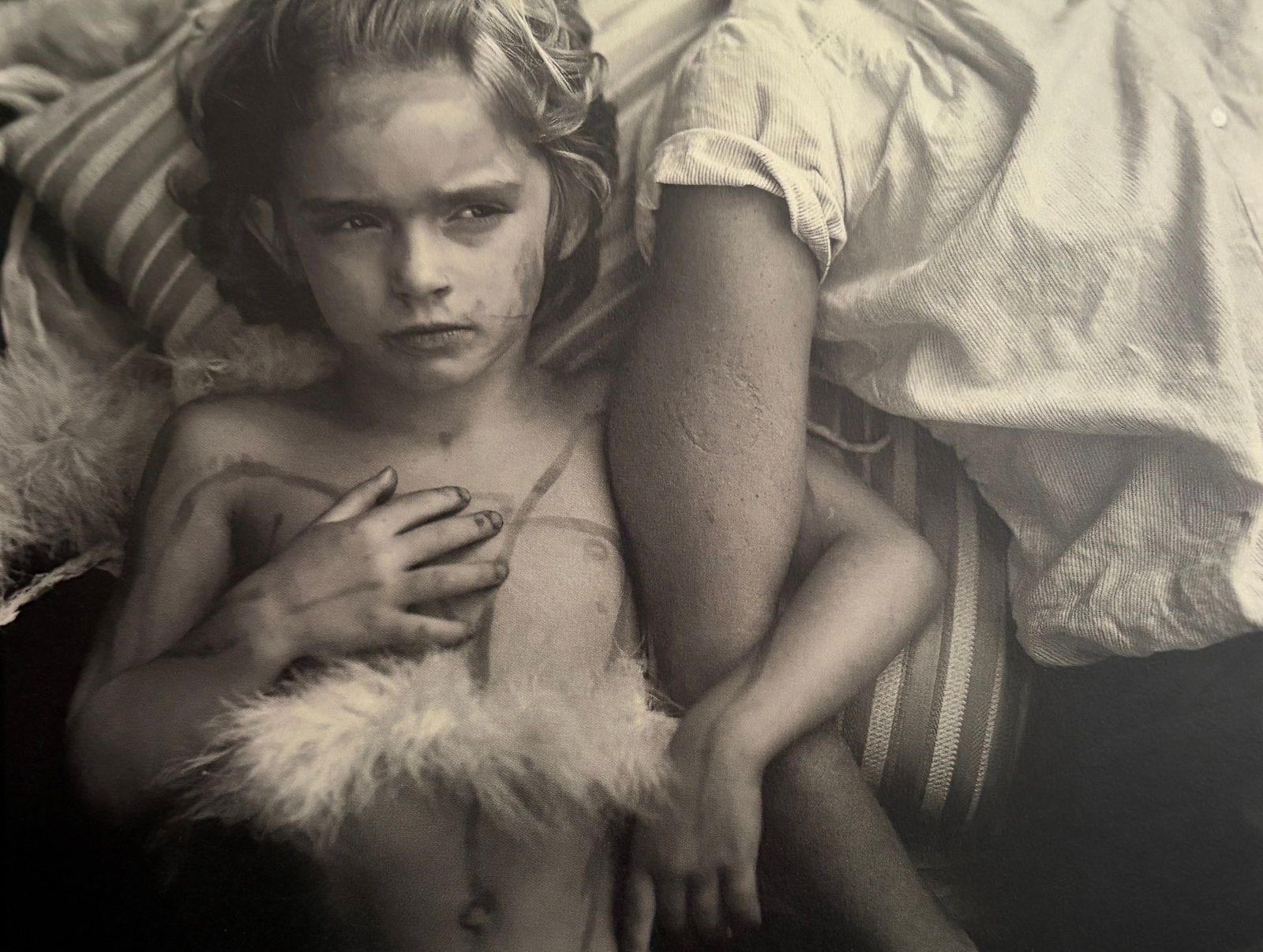 Sally Mann - Jessie Bites, 1985: SALLY MANN (B.1951) Jessie Bites, 1985 Print 7.25 inches x 6 inches