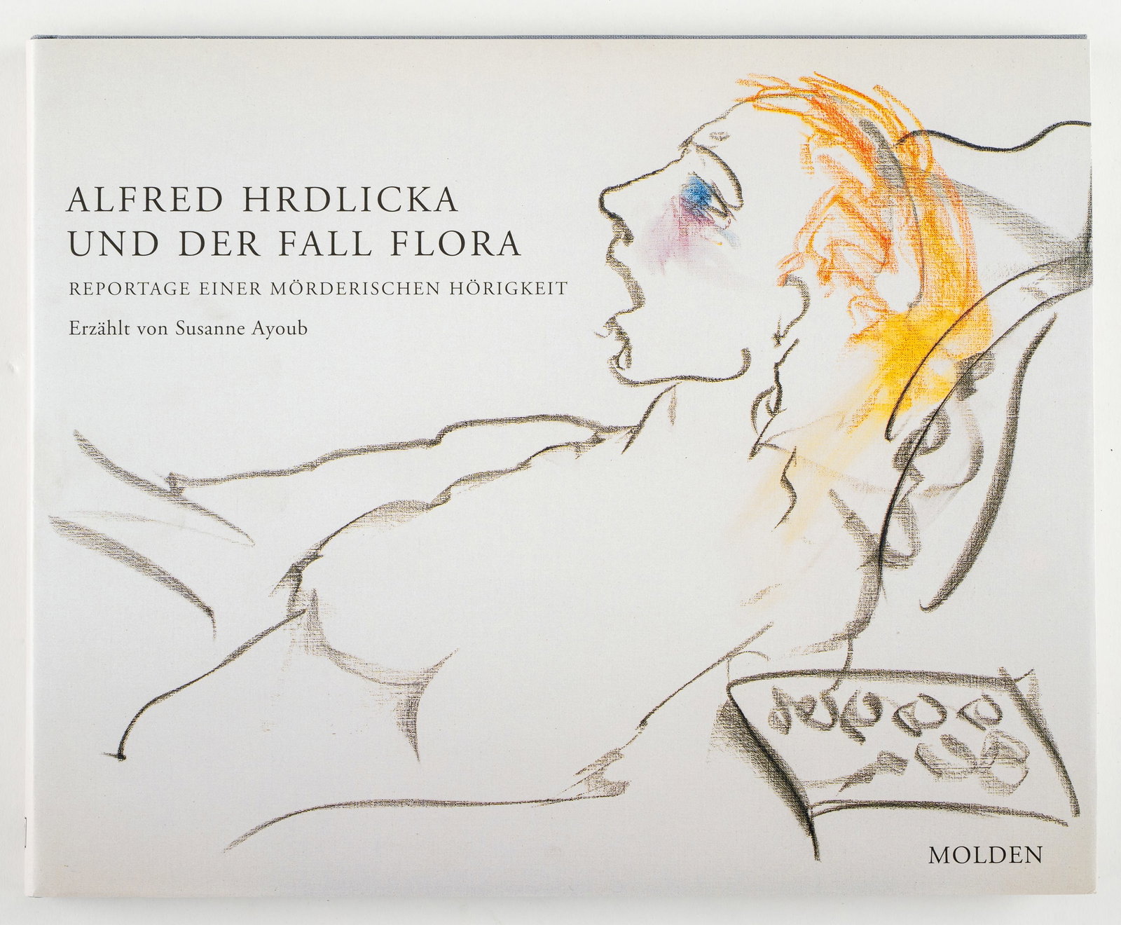 Hrdlicka, Alfred - 5