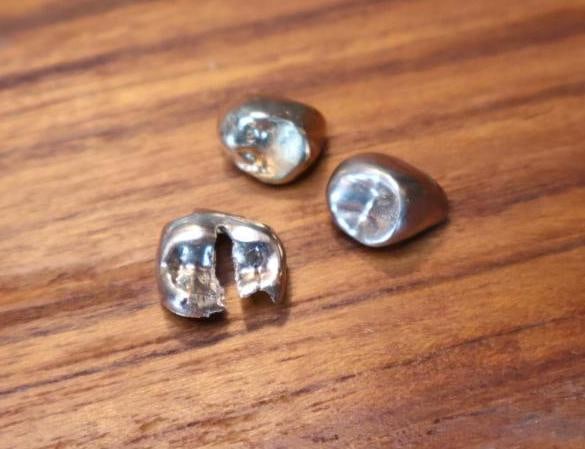 Three Gold Teeth Caps: Two appear to be implant teeth, please see all photos