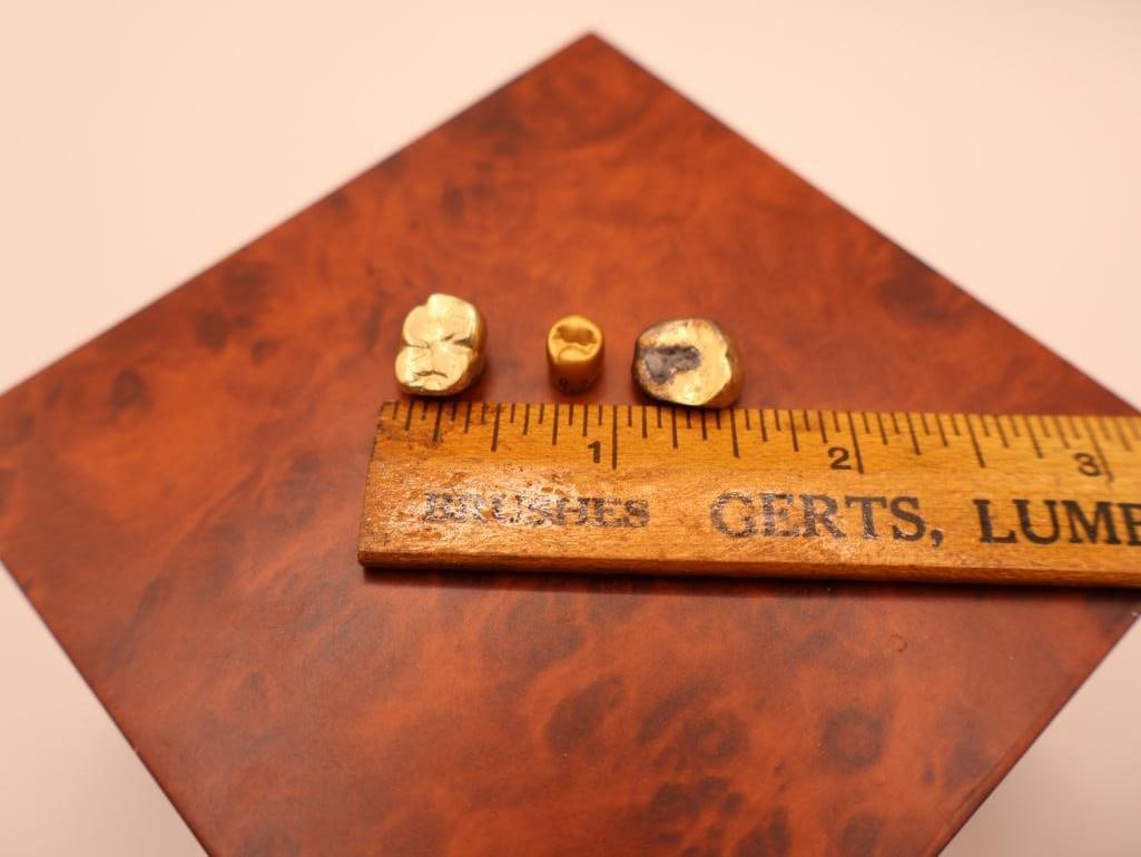 Two Gold Teeth and Dental Mold Tooth - 2