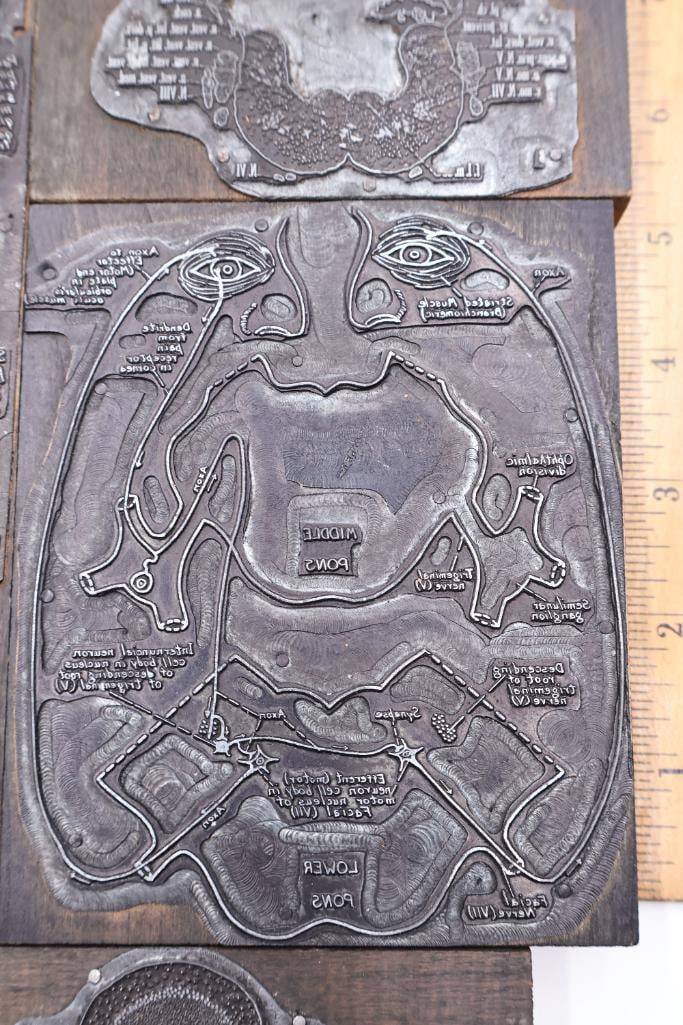 Collection of Antique Anatomical Printing Plates & Medical Illustration Blocks - 10
