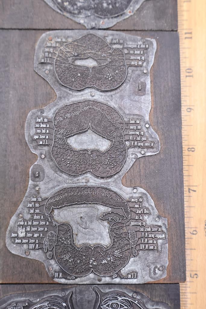 Collection of Antique Anatomical Printing Plates & Medical Illustration Blocks - 11