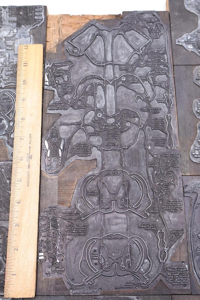 Collection of Antique Anatomical Printing Plates & Medical Illustration Blocks - 13