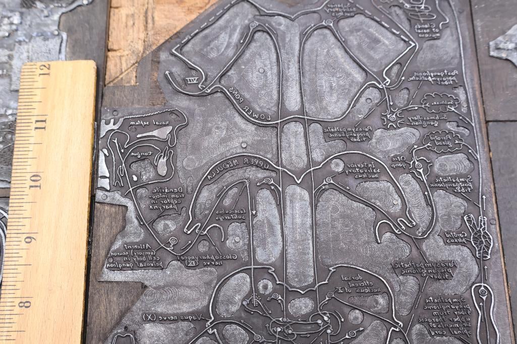 Collection of Antique Anatomical Printing Plates & Medical Illustration Blocks - 15