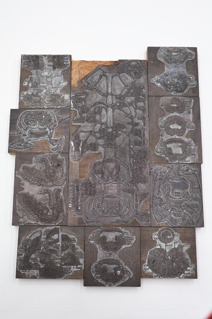 Collection of Antique Anatomical Printing Plates & Medical Illustration Blocks: Rare and fascinating collection of antique anatomical printing plates and medical illustration blocks featuring detailed cross-sectional diagrams and educational imagery of human anatomy. Includes mul