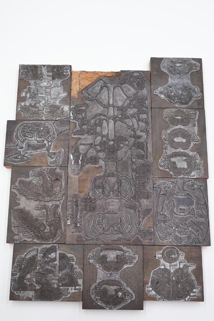 Collection of Antique Anatomical Printing Plates & Medical Illustration Blocks - 2