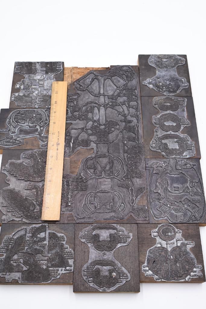 Collection of Antique Anatomical Printing Plates & Medical Illustration Blocks - 3