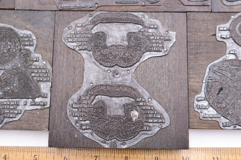 Collection of Antique Anatomical Printing Plates & Medical Illustration Blocks - 5