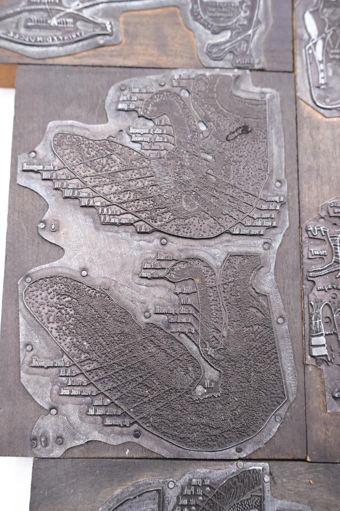Collection of Antique Anatomical Printing Plates & Medical Illustration Blocks - 7
