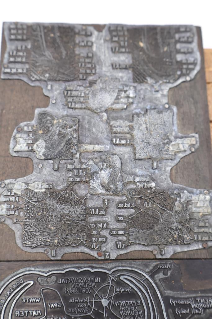 Collection of Antique Anatomical Printing Plates & Medical Illustration Blocks - 9