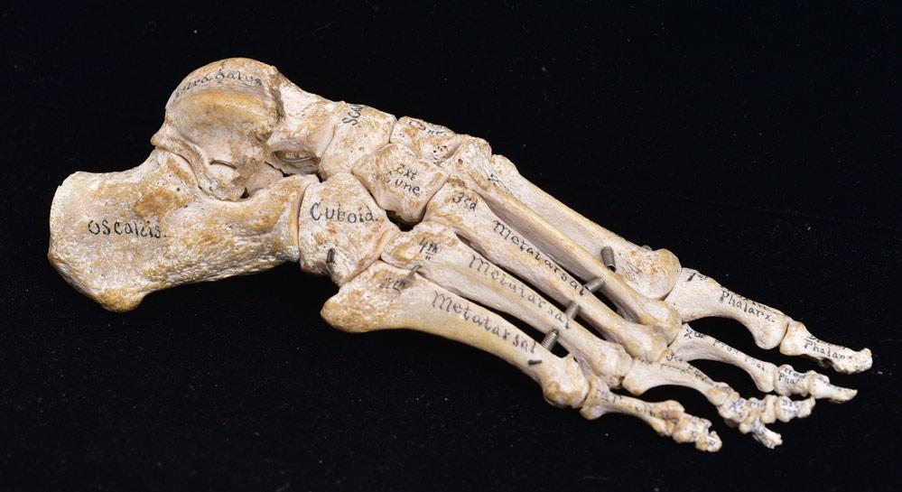 Dr. Scholl's Identified Foot Skeleton (1 of 4)