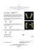 0.42 ctw Diamond Earrings - 18KT Yellow Gold - 3
